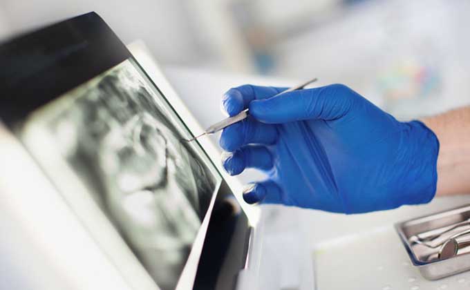 2 Common Types of Dental X-Rays